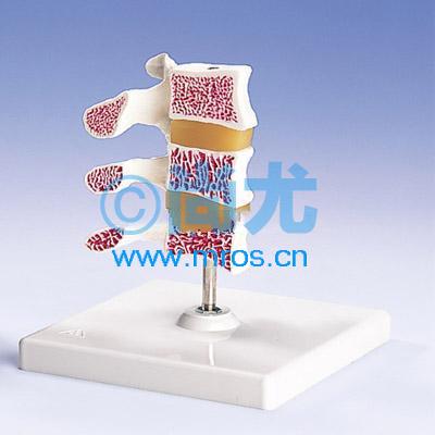 ¹֢ģ(16cm) Ŵ