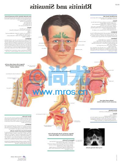 ¹ǺͼRhinitis and Sinusitis 