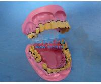 国产病态牙齿口腔模型 -点击放大